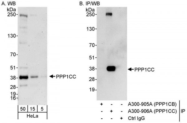 Anti-PPP1CC