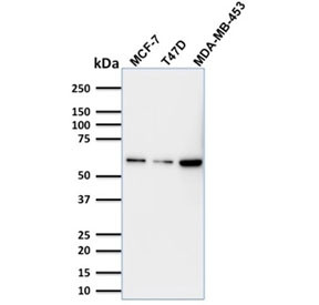 Anti-p63 / Tumor protein 63, clone TP63/1786