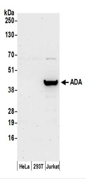 Anti-ADA/Adenosine Deaminase