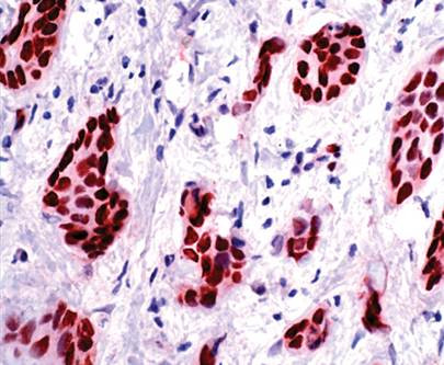 Anti-Progesteron Receptor, clone SP2
