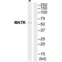 Anti-MATK