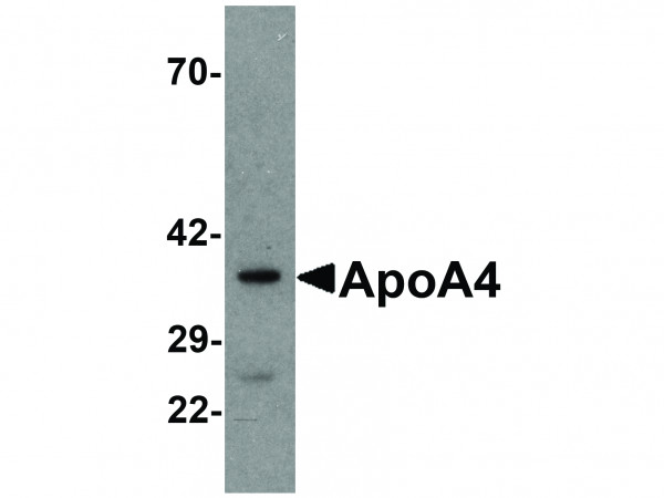 Anti-ApoA4