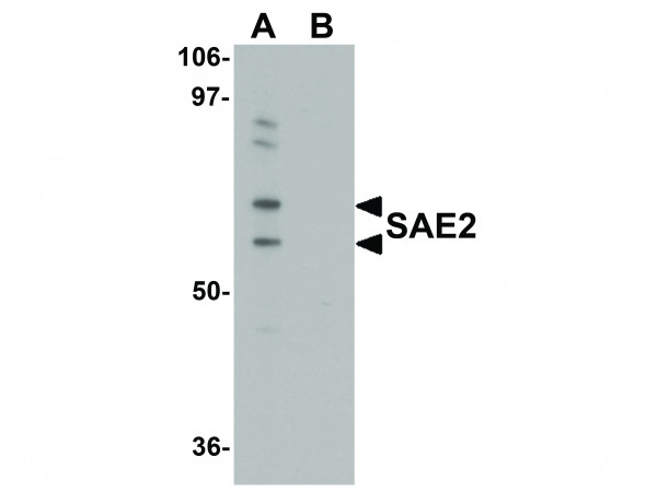 Anti-SAE2