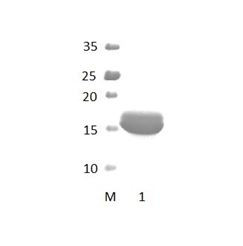 DLG5_1 PDZ Domain