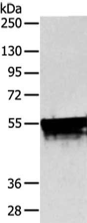 Anti-KRT4