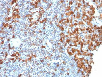 Anti-AIF1 / Iba1 (Microglia Marker) Recombinant Mouse Monoclonal Antibody (clone:rAIF1/1909)