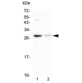 Anti-Oncostatin M / OSM