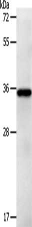 Anti-LPPR5