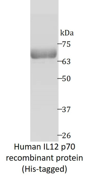 Human IL12 p70 recombinant protein (Active) (His-tagged)