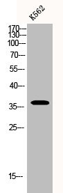 Anti-BNIP2