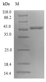 GTP-binding protein SAR1a (SAR1A), human, recombinant