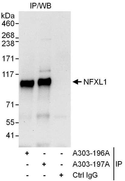 Anti-NFXL1