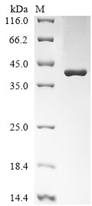 Apolipoprotein A-I (APOA1), partial, bovine, recombinant