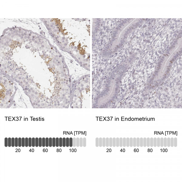 Anti-TEX37