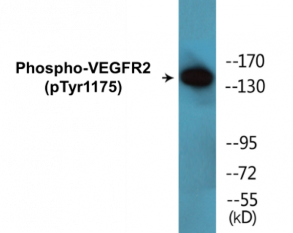 VEGFR2 (Phospho-Tyr1175) Colorimetric Cell-Based ELISA Kit