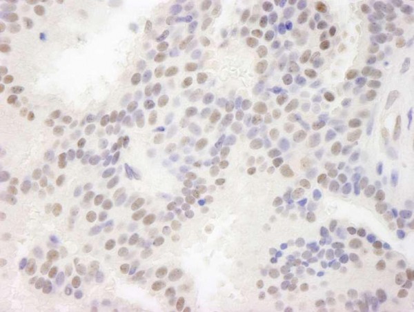 Anti-MAML3 (IHC)