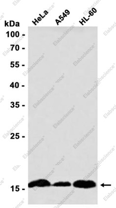 Anti-Recombinant SUMO Conjugating Enzyme UBC9, clone C113140
