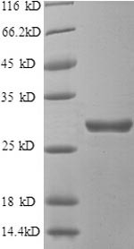Beta-adrenergic receptor kinase 1 (GRK2), partial, human, recombinant