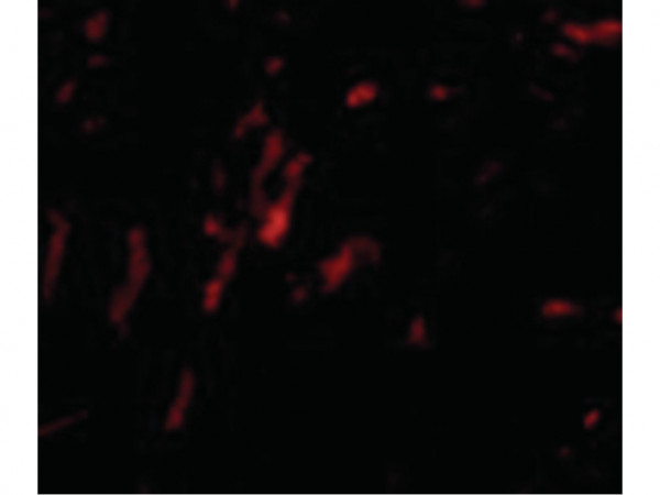 Anti-CDCA8