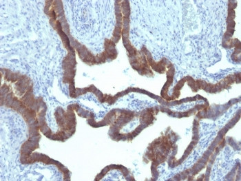 Anti-KRT7 / Cytokeratin 7, clone KRT7/903