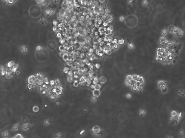 B-LCL-HROC43 Cells