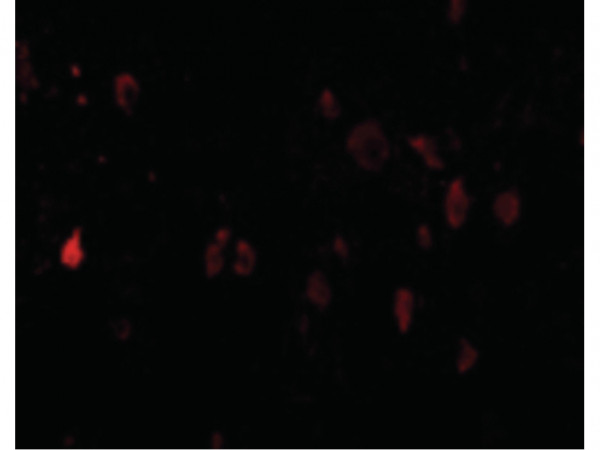 Anti-PD-L2