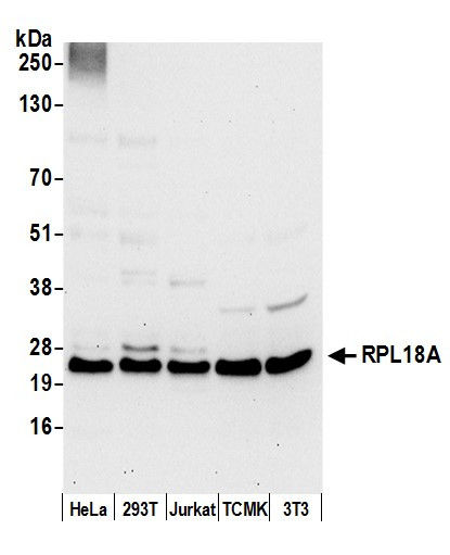 Anti-RPL18A/Ribosomal Protein L18a