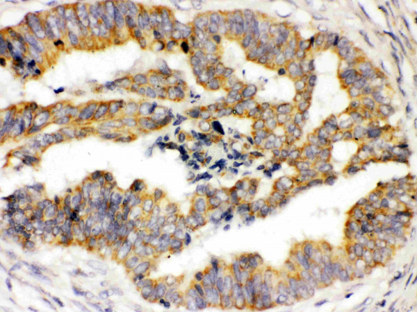 Anti-TRPM4