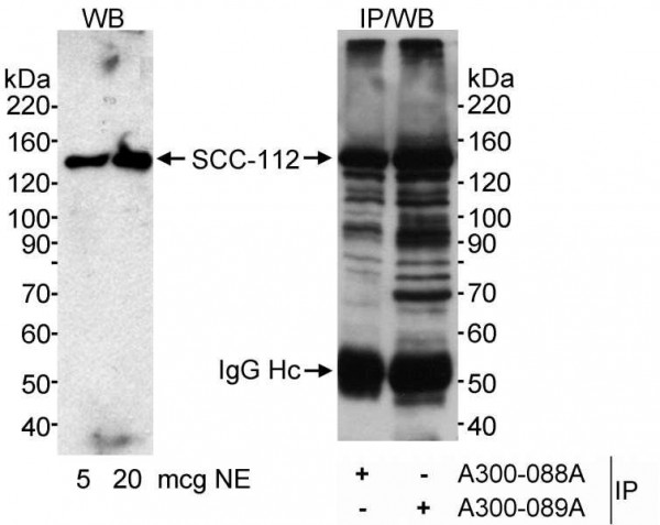 Anti-SCC-112
