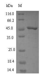 Squalene synthase (FDFT1), partial, human, recombinant