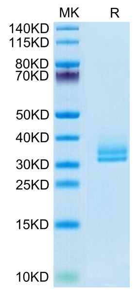 Biotinylated Human ANGPTL2/Angiopoietin-like 2 Protein