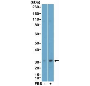 Anti-phospho-EIF4E (pSer209), clone RM452