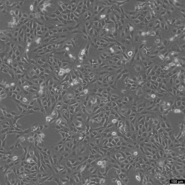 RBE Cells