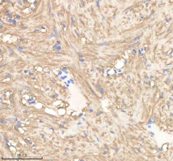 Anti-Zebrafish Pgam1 / Pgam1a / Pgam1b / Phosphoglycerate mutase