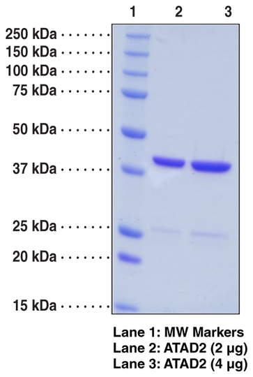 ATAD2 bromodomain (human recombinant)