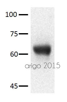 Anti-Tyrosine Hydroxylase