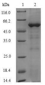 Alcohol dehydrogenase class-3 (ADH2), Arabidopsis thaliana, recombinant