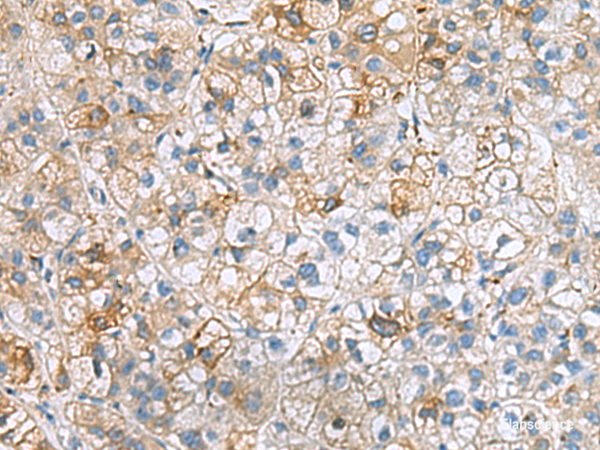 Anti-IGLL1