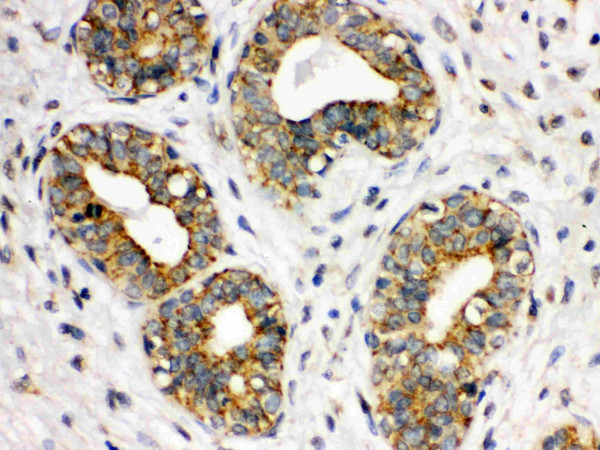 Anti-CD41