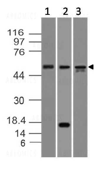 Anti-Caspase-8 (Clone: ABM14C1)