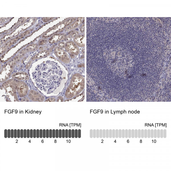 Anti-FGF9