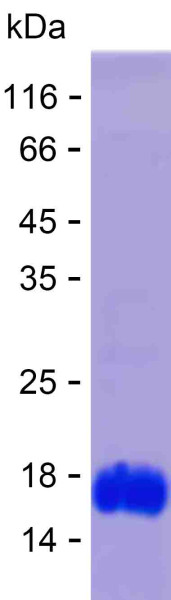 Recombinant Human Vitamin D3 Receptor Protein