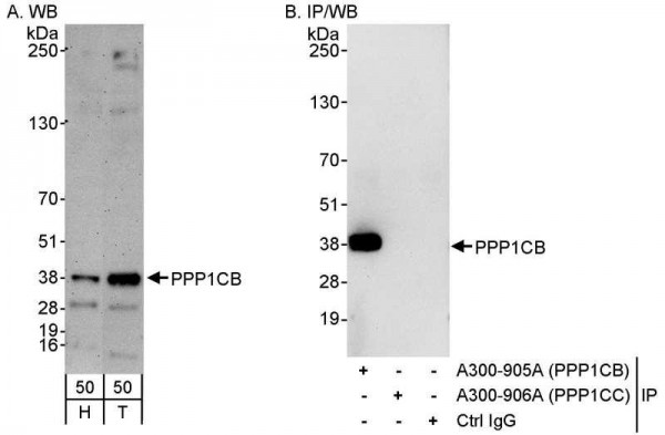 Anti-PPP1CB