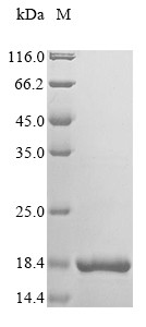 Microtubule-associated serine/threonine-protein kinase 4 (MAST4), partial, human, recombinant