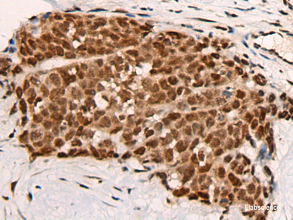Anti-HGH1