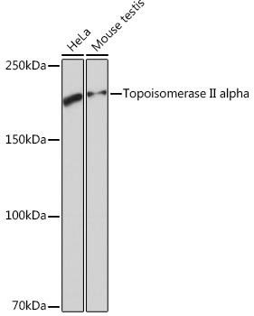 Anti-DNA topoisomerase II alpha (TOP2A)