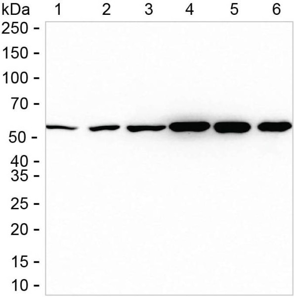Anti-ATP6V1B1