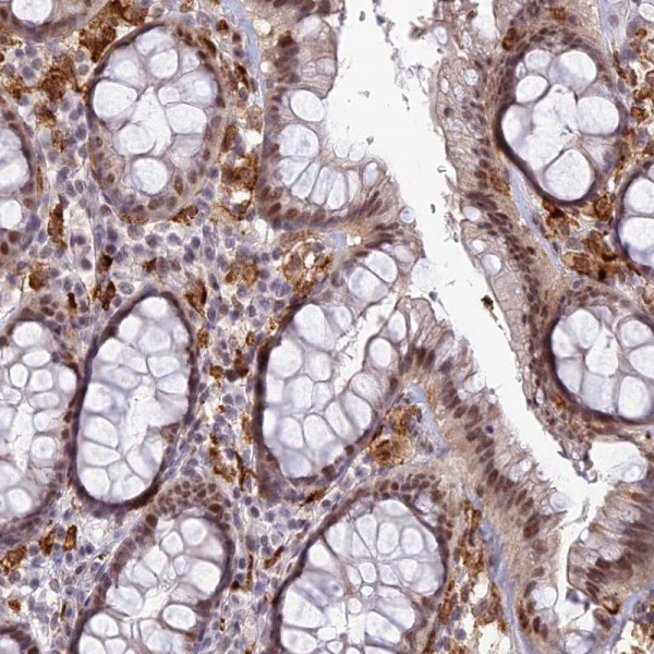 Anti-ABHD17A