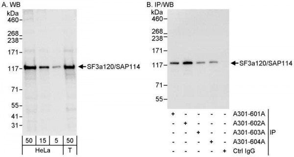 Anti-SF3a120/SAP114