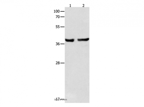 Anti-SERPINB5
